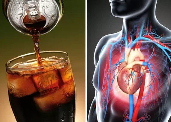 The Dark Side of Sugary Drinks